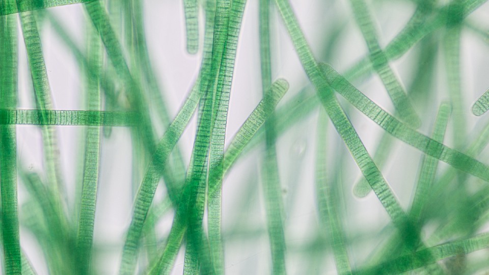 Cyanobacteria filaments under a microscope.