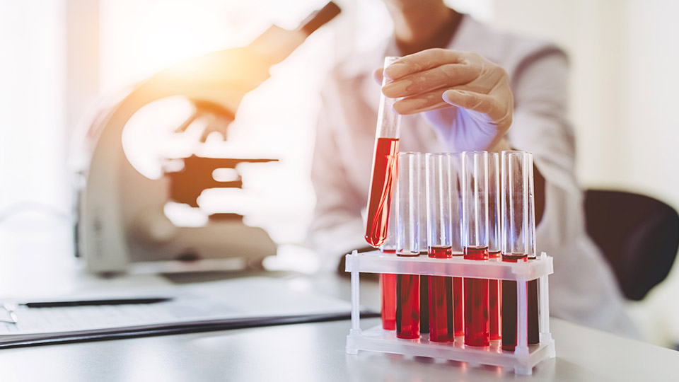 Pictured is a scientist with test tubes.